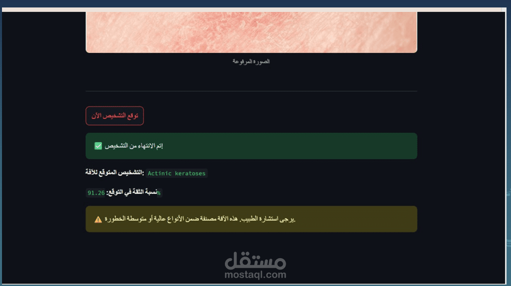 SKIN CANCER DETICTION