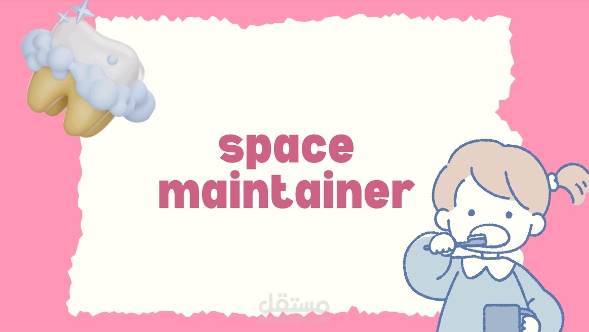عرض تقديمي (PowerPoint) لطب أسنان الأطفال - Space Maintainer
