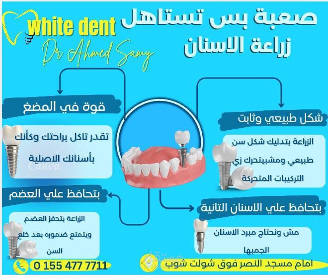 تصميم إعلان تسويقي لعيادة أسنان يبرز فوائد زراعة الأسنان