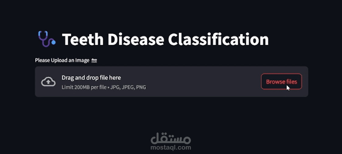 Teeth Disease Classification