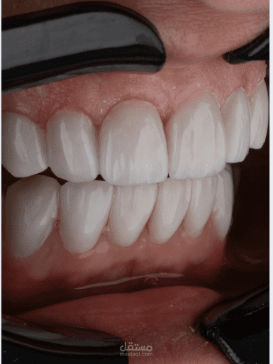 تطبيق ويب لادارة عيادة طبيب أسنان