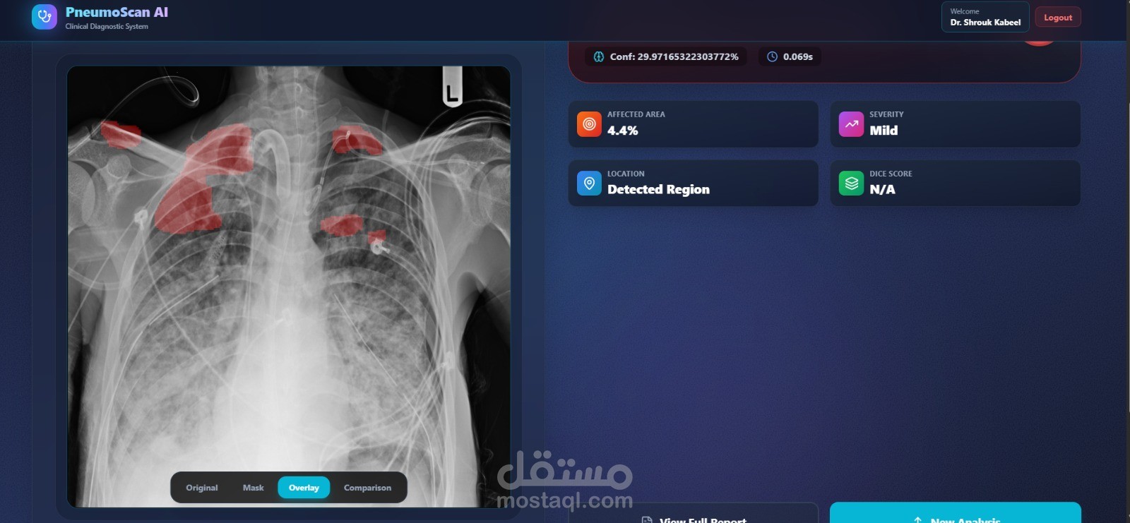تطبيق ذكاء اصطناعي لتشخيص أمراض الرئة من الأشعة السينية (PneumoScan AI)