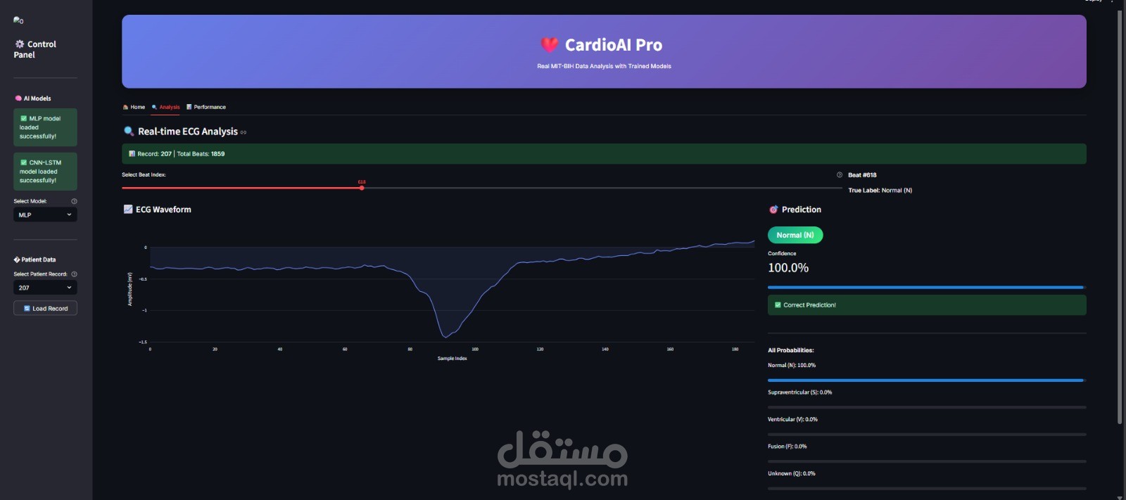 نظام معتمد على الذكاء الاصطناعي للكشف التلقائي عن أمراض اختلال ضربات القلب (ECG Arrhythmia Detection)