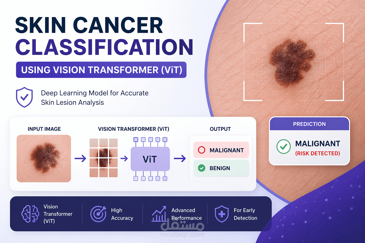 تصنيف سرطان الجلد باستخدام Vision Transformer (ViT)