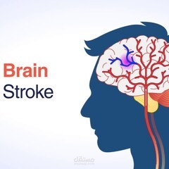 مشروع التنبؤ بالسكتة الدماغية (Brain Stroke Prediction)