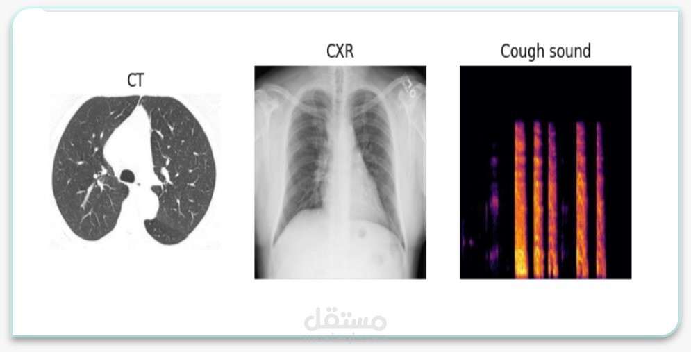 Multi-Modal Medical Diagnosis using Intermediate Fusion CNN
