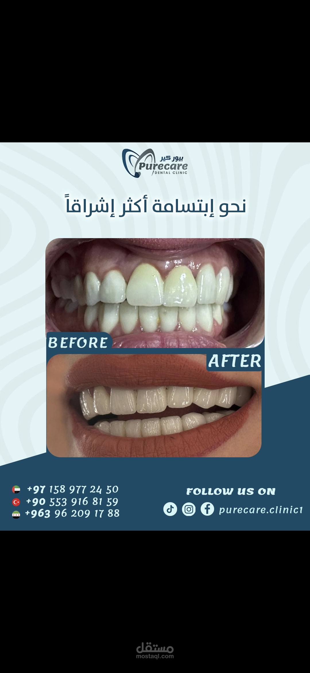 اعلان سوشيال ميديا لعيادة اسنان