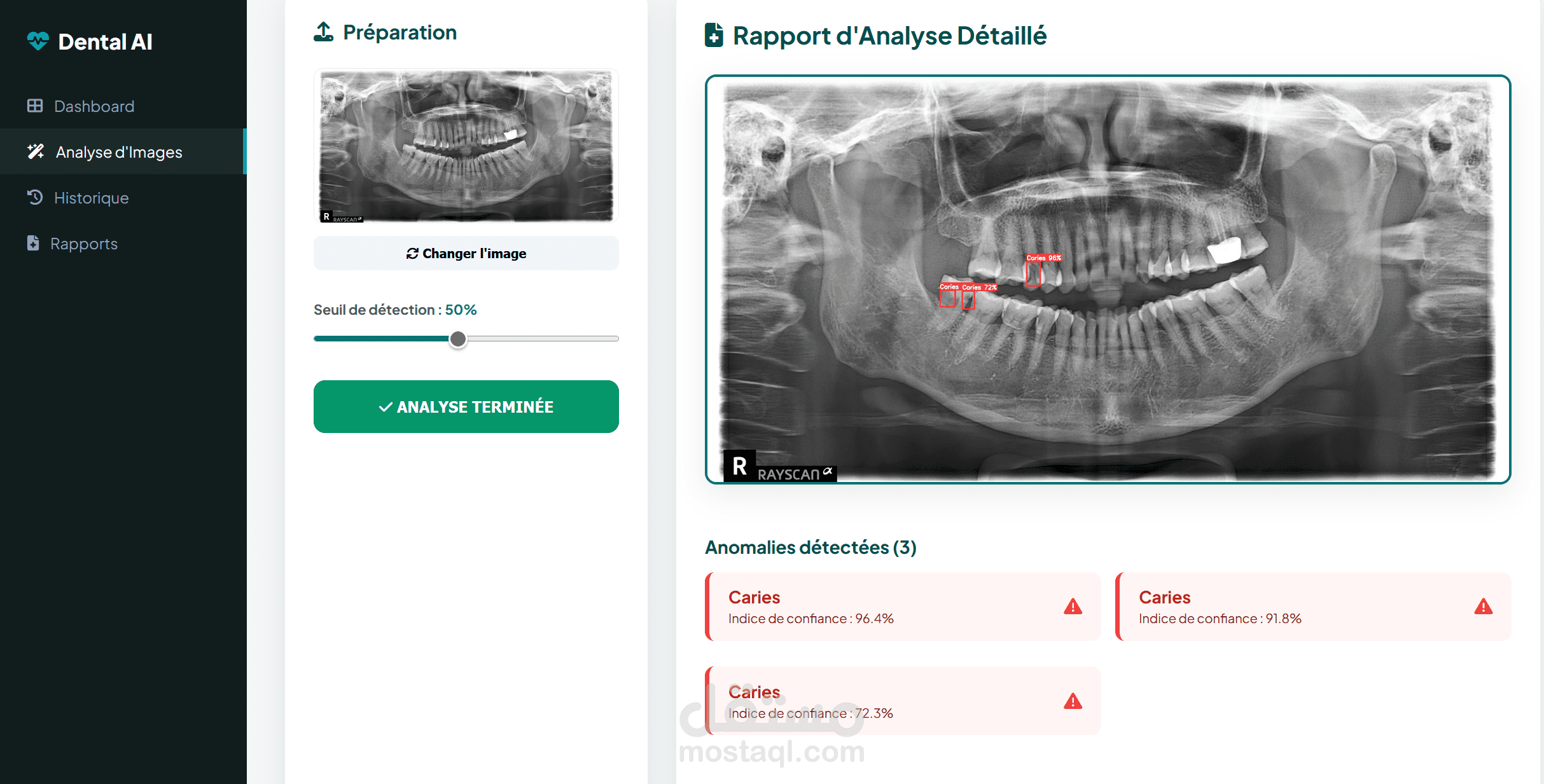 كشف تلقائي لـ 6 أمراض سنية بالذكاء الاصطناعي — دقة 96%