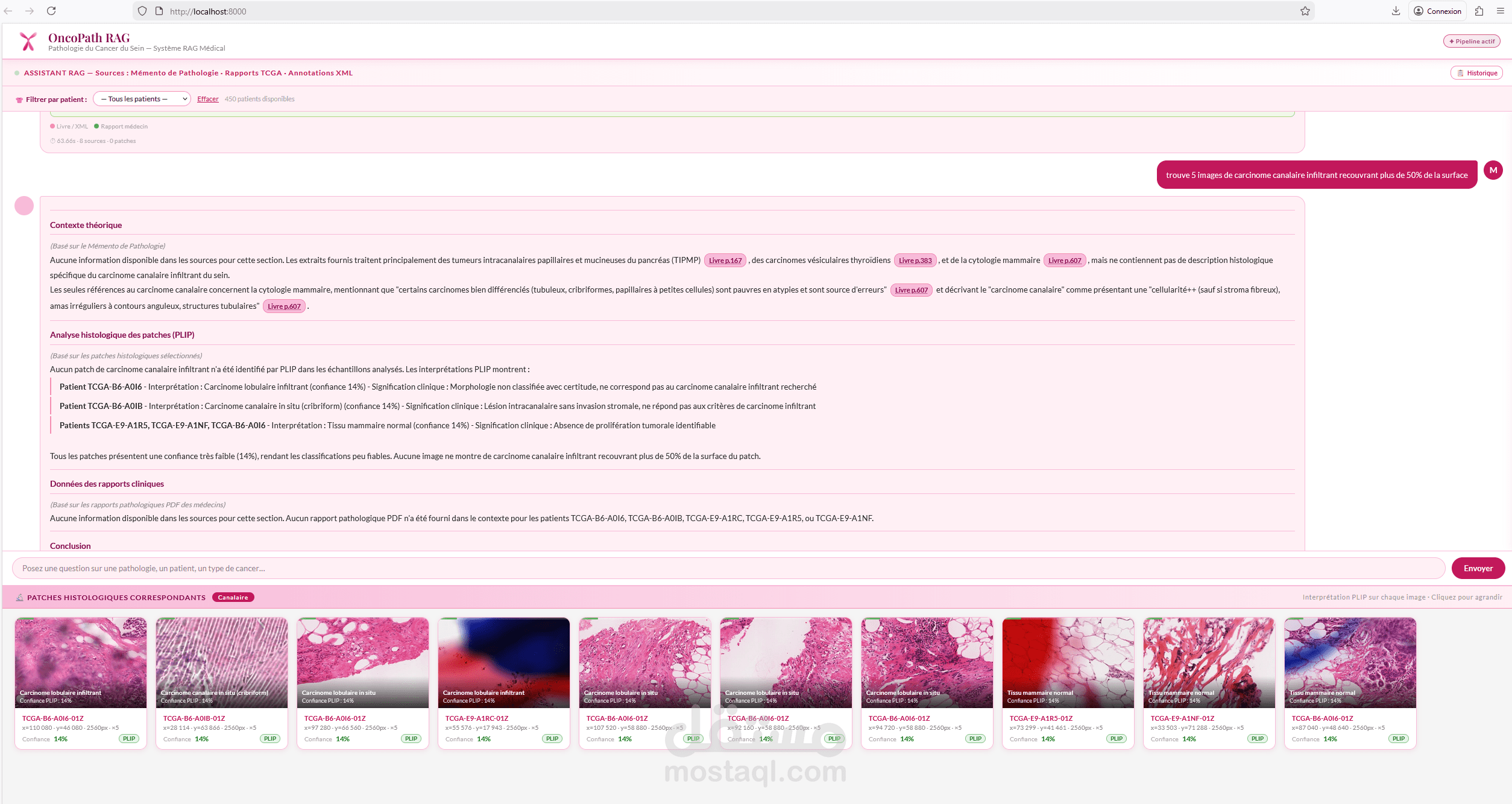 منصة ذكاء اصطناعي متكاملة للتحليل النسيجي لسرطان الثدي باستخدام تقنية RAG
