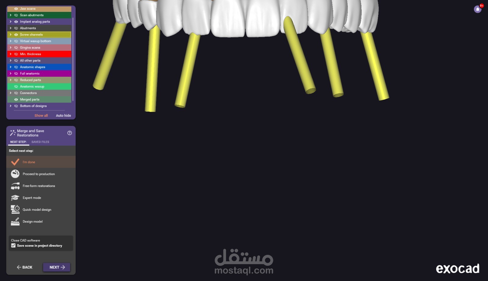 "تصميم طقم أسنان كامل (All-on-X) باستخدام برنامج Exocad بدقة عالية"