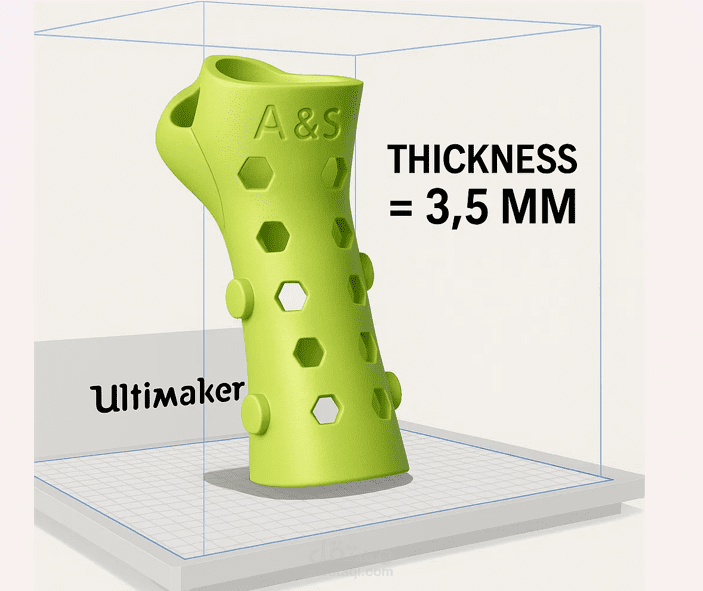 3D Printed Smart Hand Splint