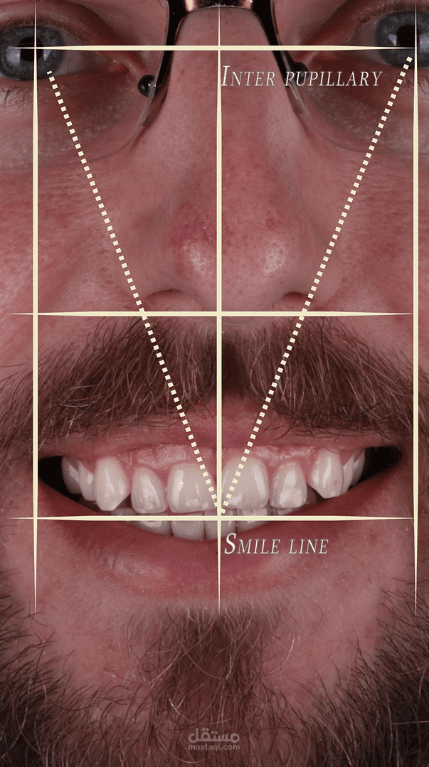 Dental motion graphics case