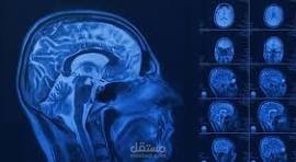استخدام الذكاء الاصطناعي في التنبؤ بأورام وسرطان المخ