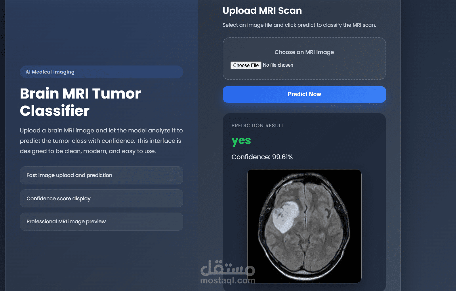 Brain MRI