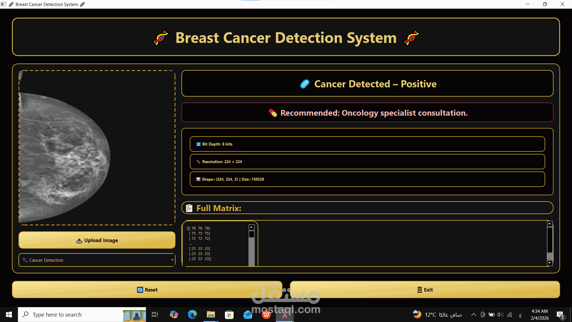 The Breast Cancer Intelligent Detection System (BCIDS)