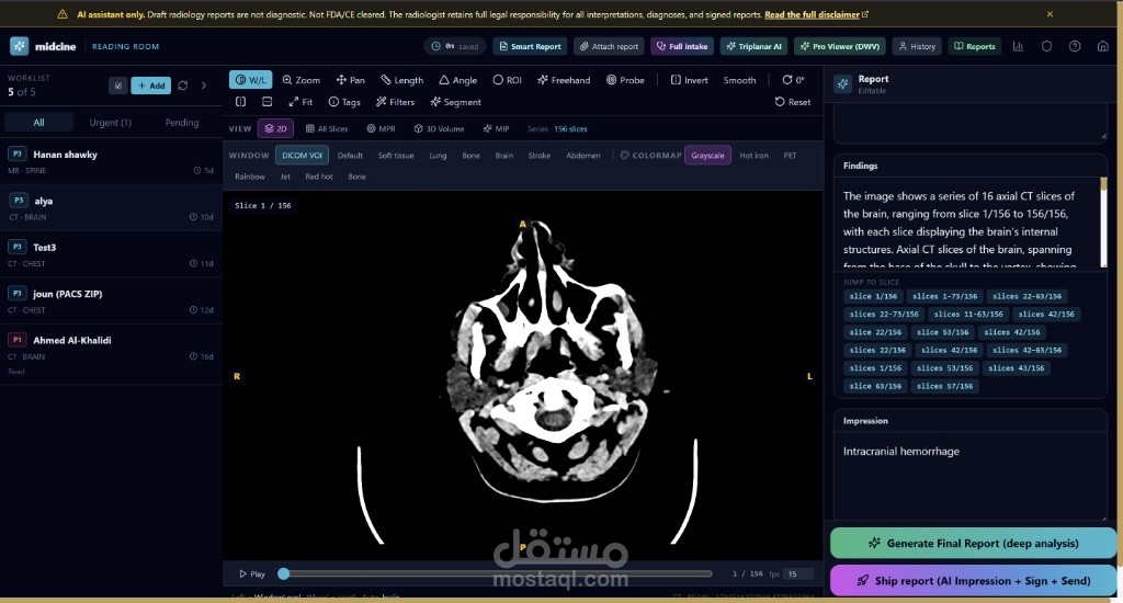 منصة Midcine v1.0 - مساعد ذكي متكامل لأطباء الأشعة (AI-Assisted Radiology Platform)