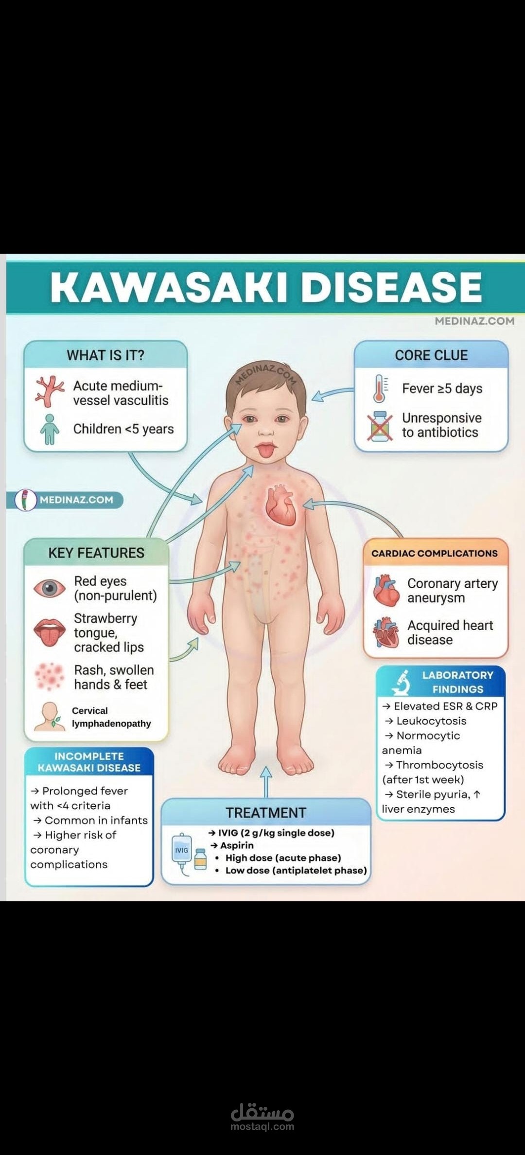 Summary of Kawasaki disease