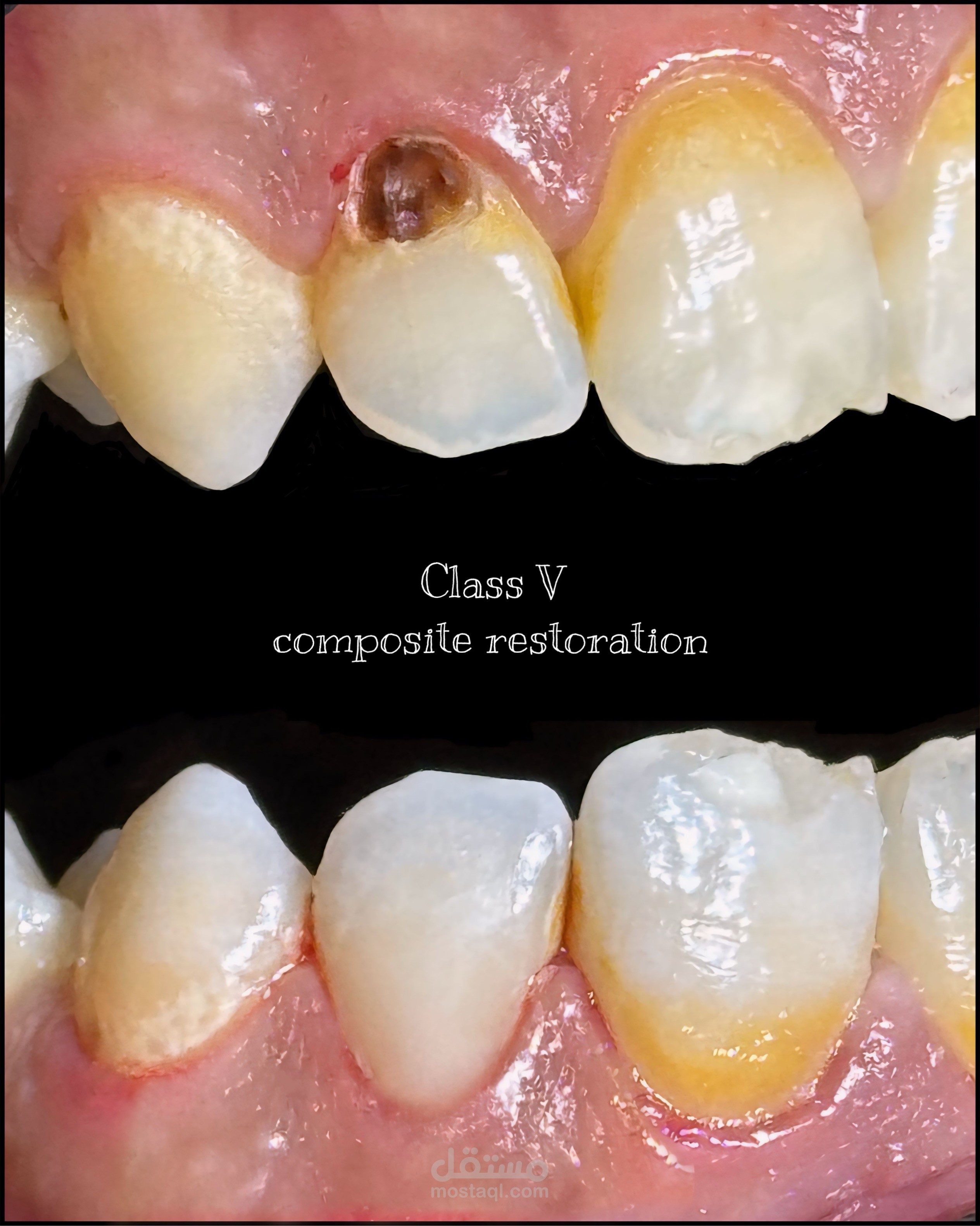 Dental Case Presentation Design | Before & After