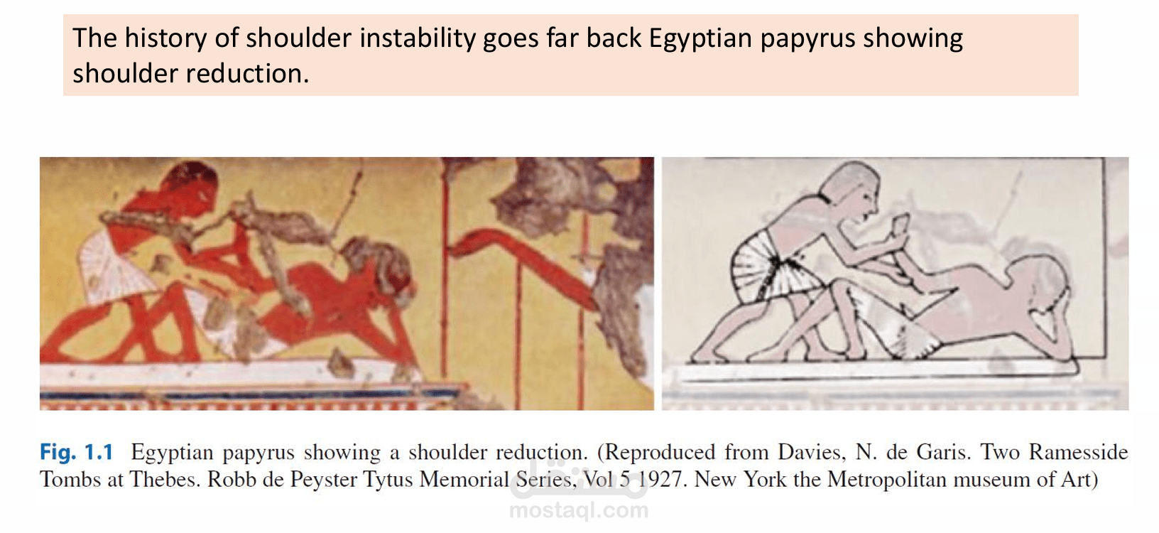Shoulder Instability