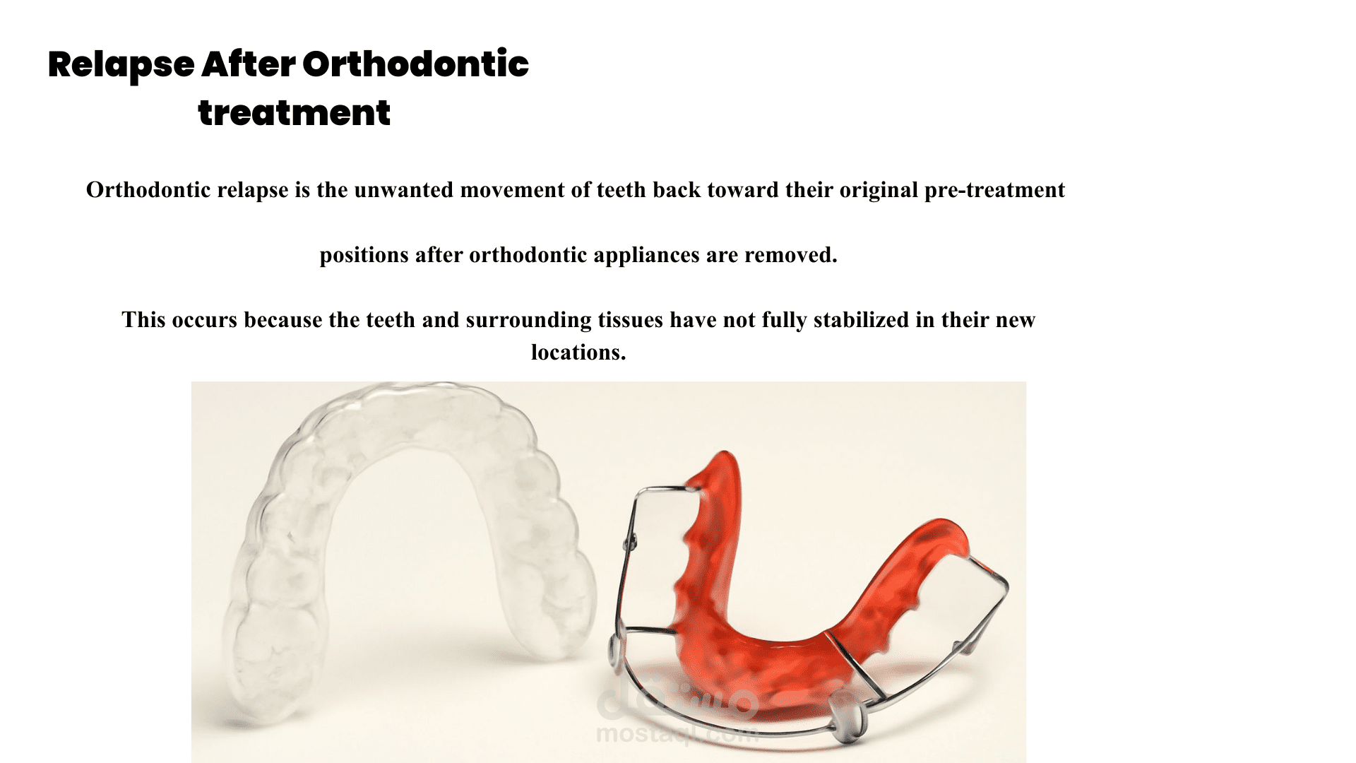 Medical Article: Orthodontic Relapse Explained Simply