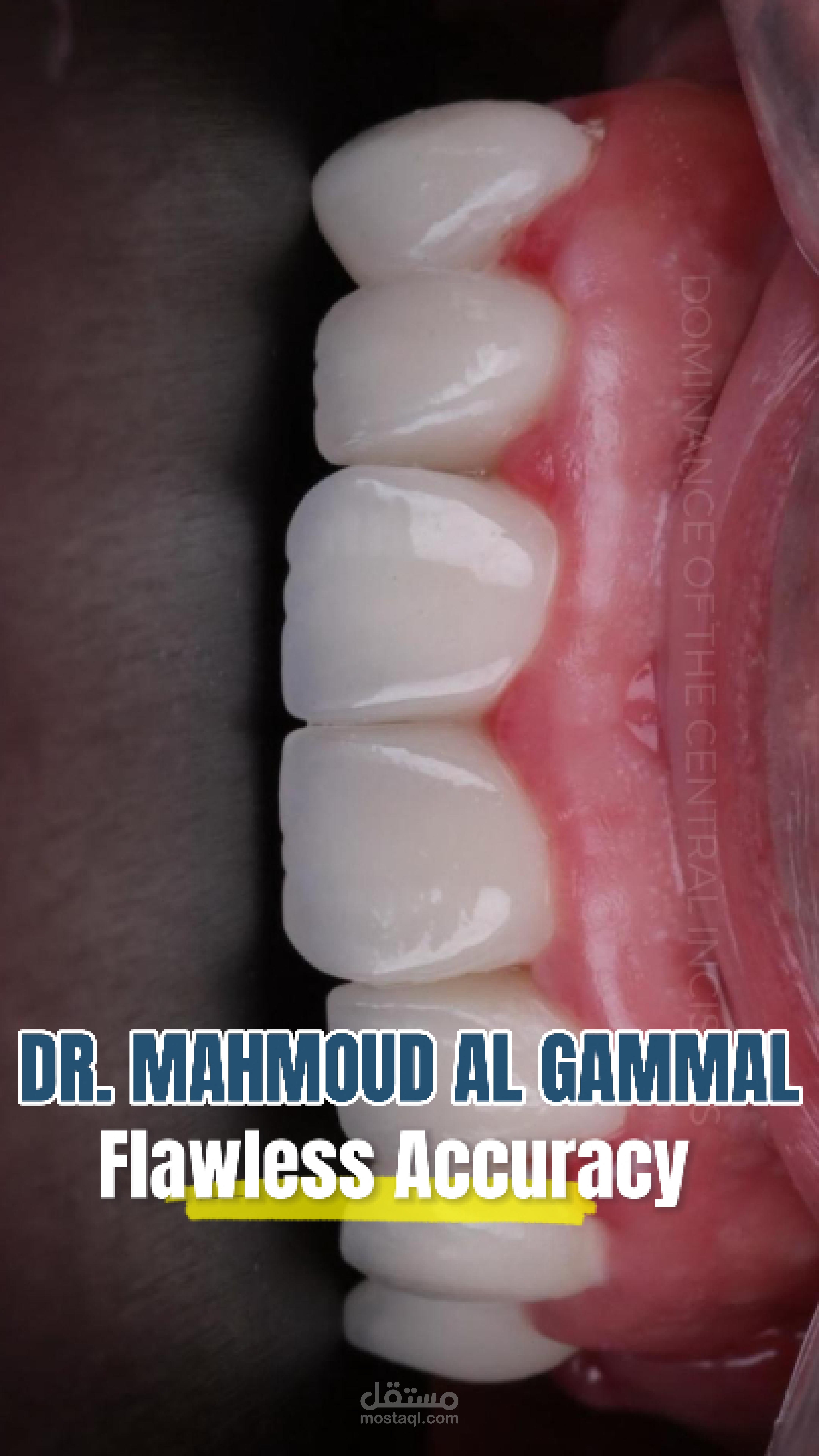 dental motion graphic video