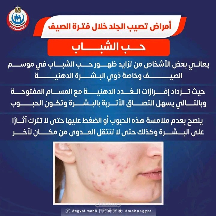 العنايه بالبشرة الدهنيه في الصيف: 7أخطاء تسبب ظهور الحبوب