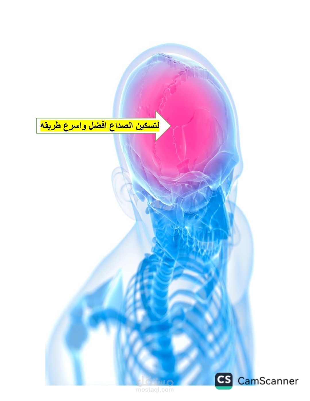 التسكين الصداع افضل واسرع طريقه