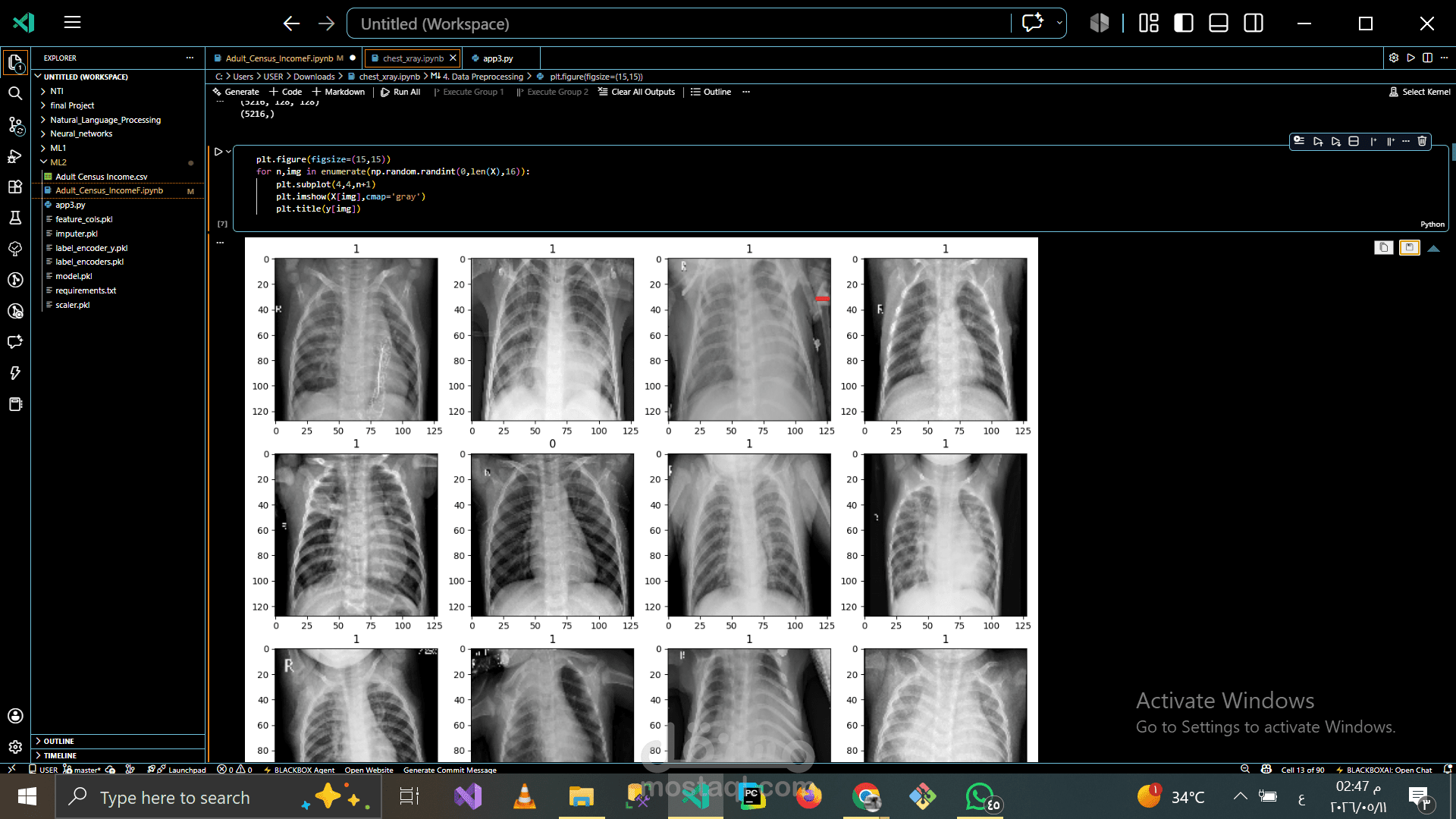 CNN_XRay_cheest_classifacation