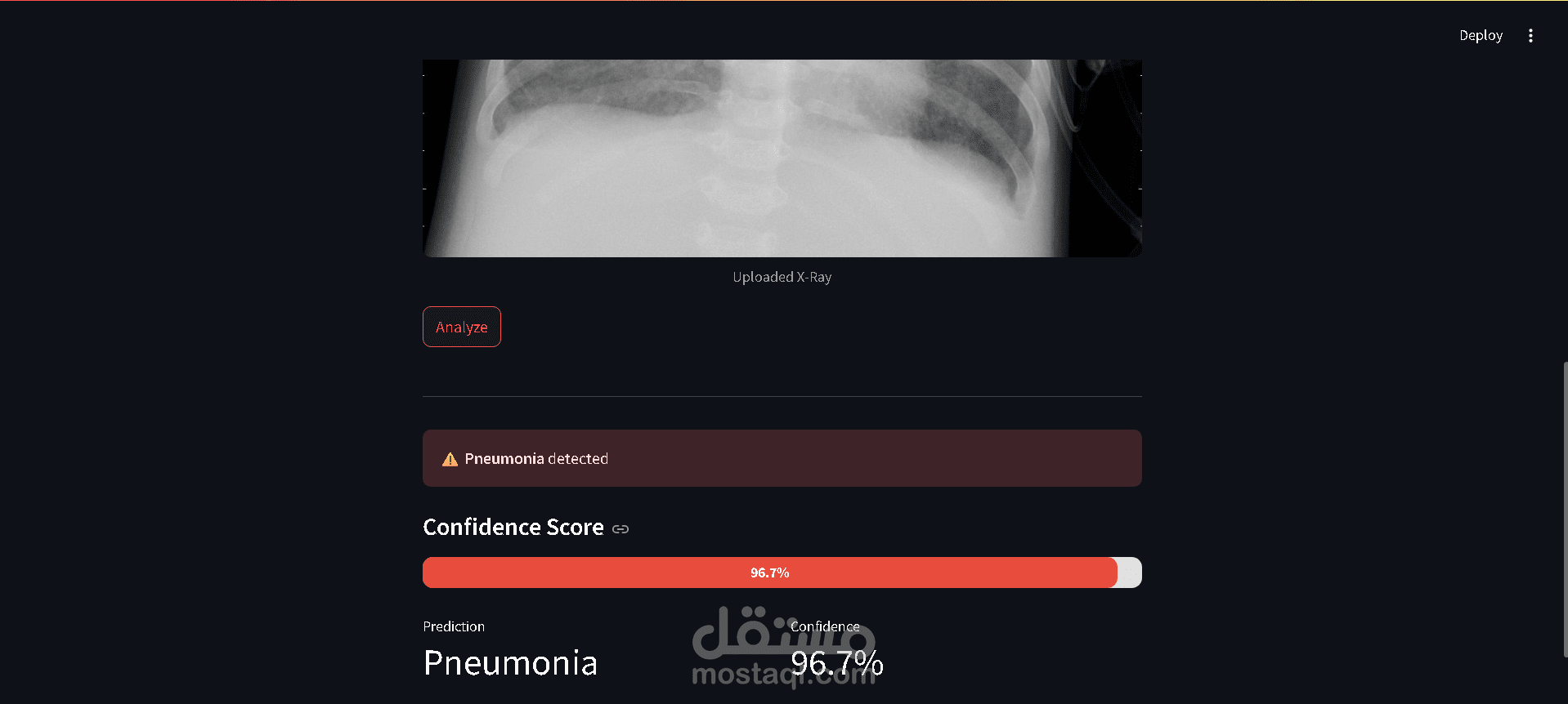 Chest X-Ray Pneumonia Classifier