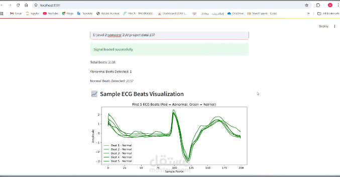 ECG Signal Analysis System