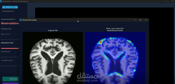 Deep Learning Brain Tumor Segmentation System