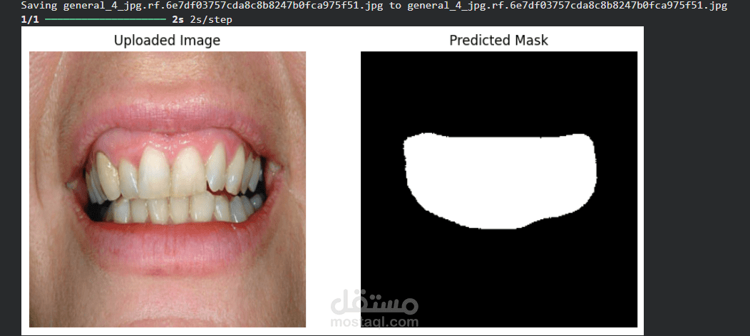 TeethSegment AI: Dental Image Segmentation using ResNet50 U-Net