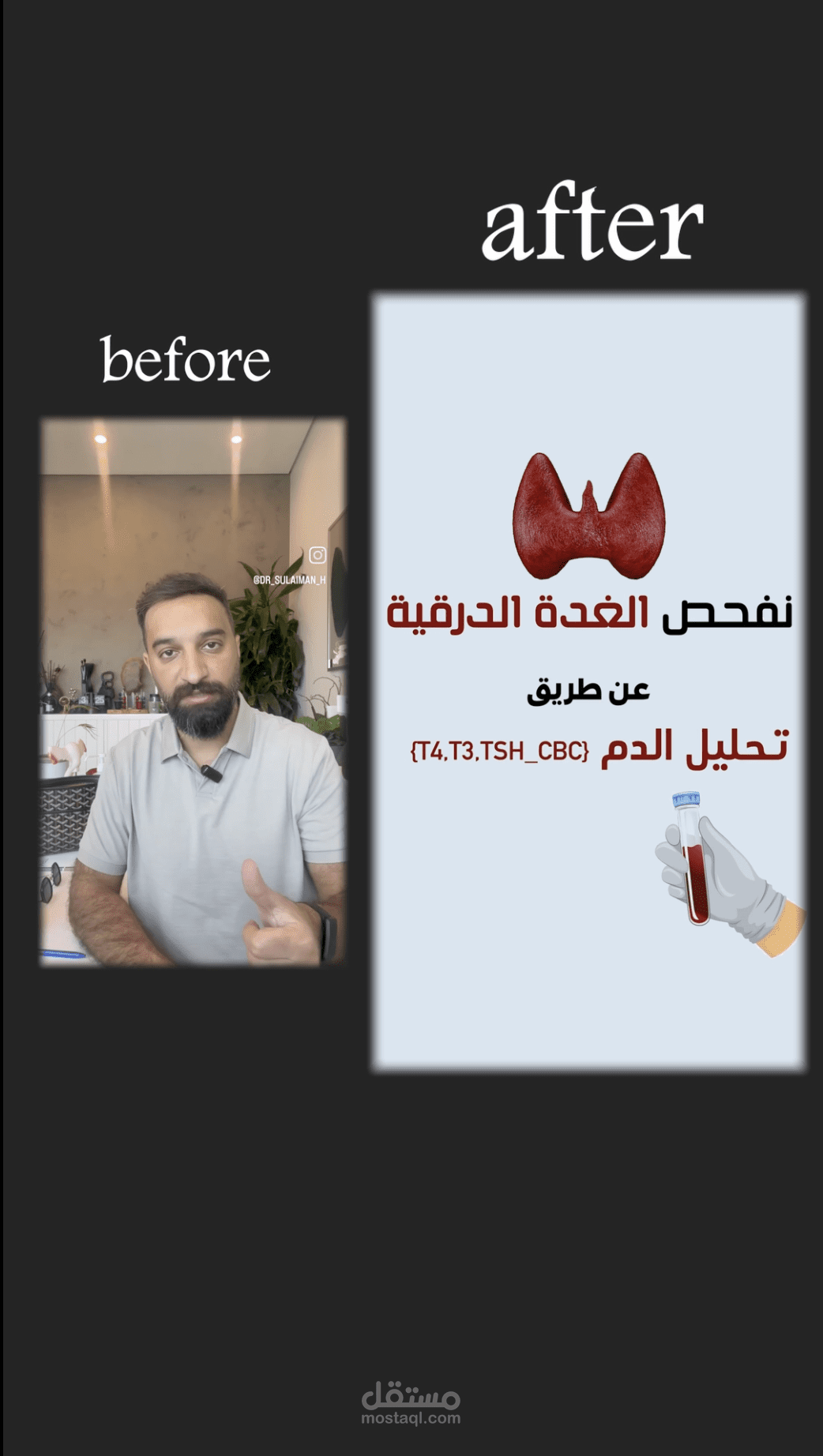 مونتاج ريلز طبي احترافي