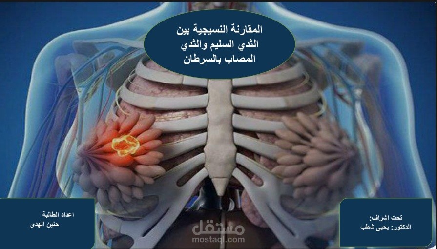 عرض تقديمي طبي: سرطان الثدي - المقارنة بين النسيج السليم والمصاب