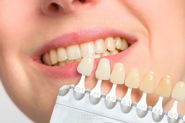 تصميم ملف pdf بشكل احترافي وبسيط يوضح اهميه " composite layering technique and in dentistry "