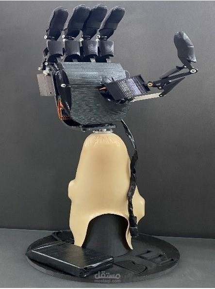 prosthetic hand