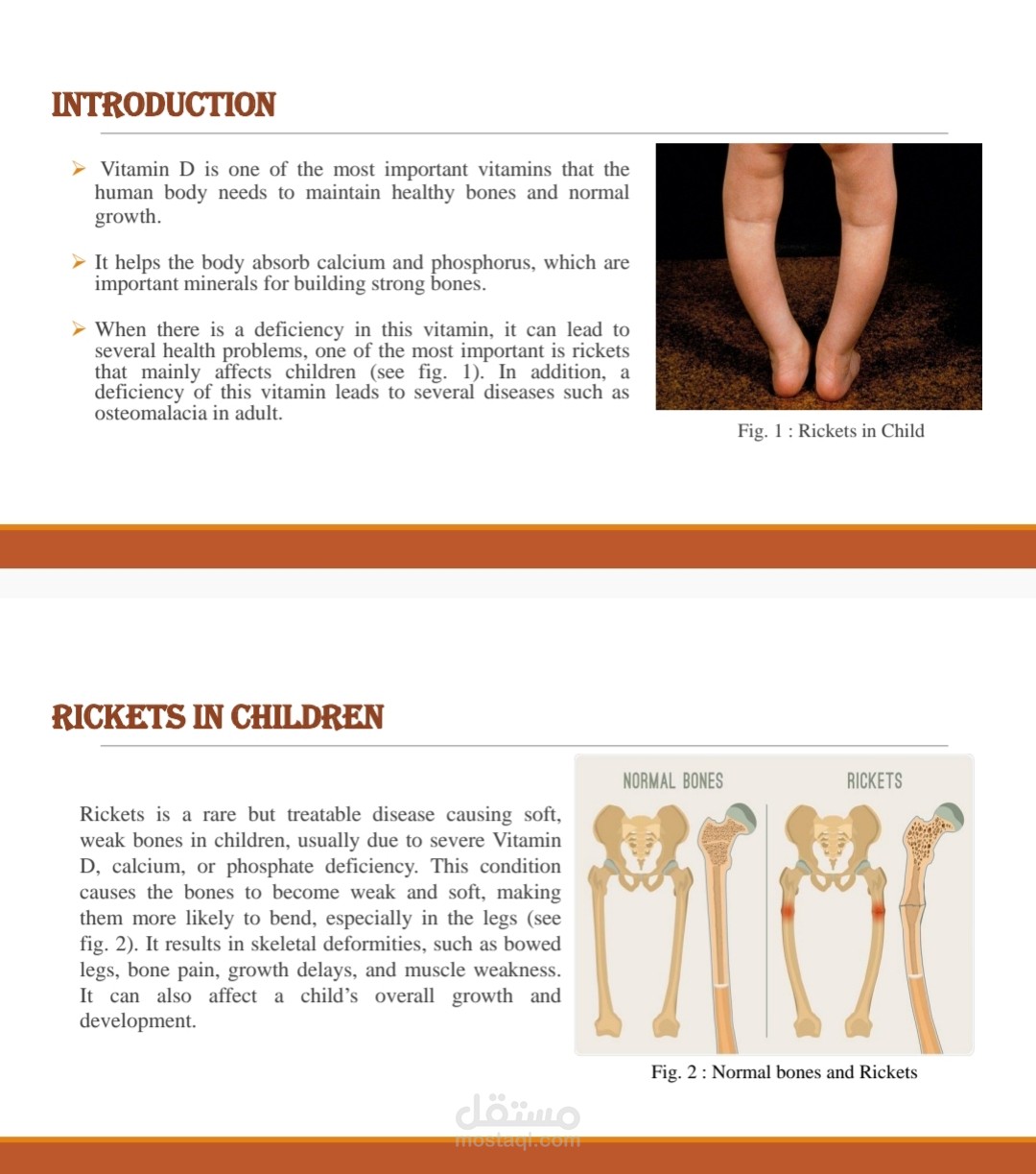 PowerPoint Presentation on Vitamin D Deficiency