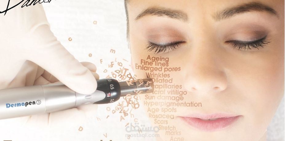 تقنيَّة الديرمابين للوجه