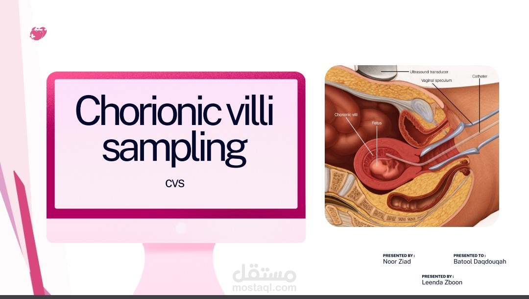Chorionic Villus Sampling (CVS) – Prenatal Diagnostic Test Presentation