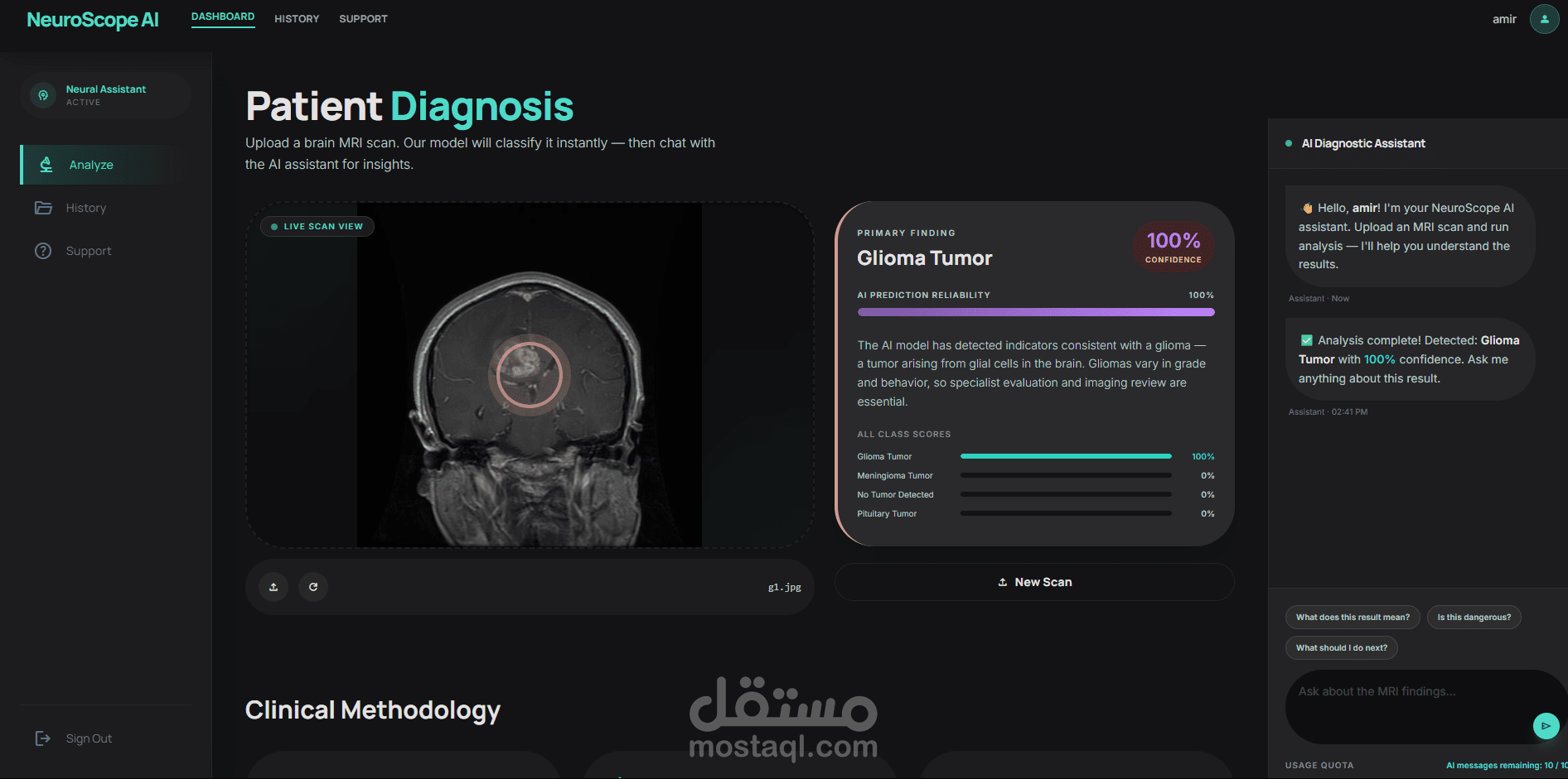 تطبيق ويب لتصنيف أورام الدماغ - NeuroScope AI