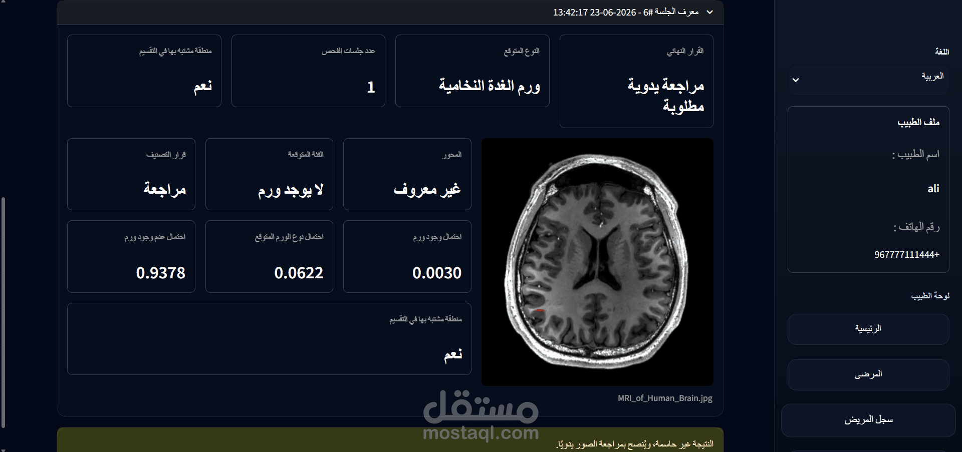 نظام ذكاء اصطناعي لتشخيص أورام الدماغ باستخدام صور الرنين المغناطيسي (MRI)