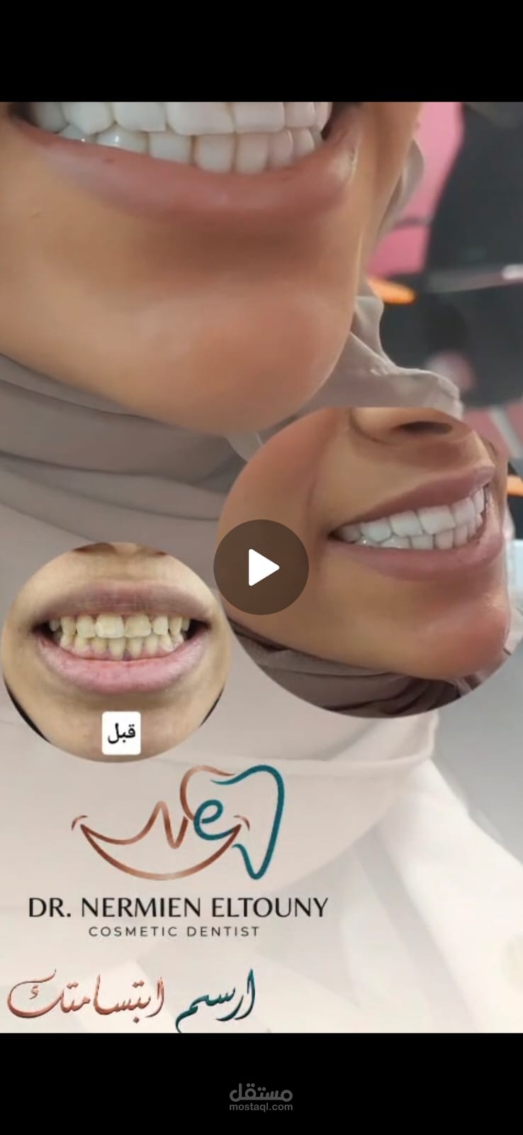 مونتاج