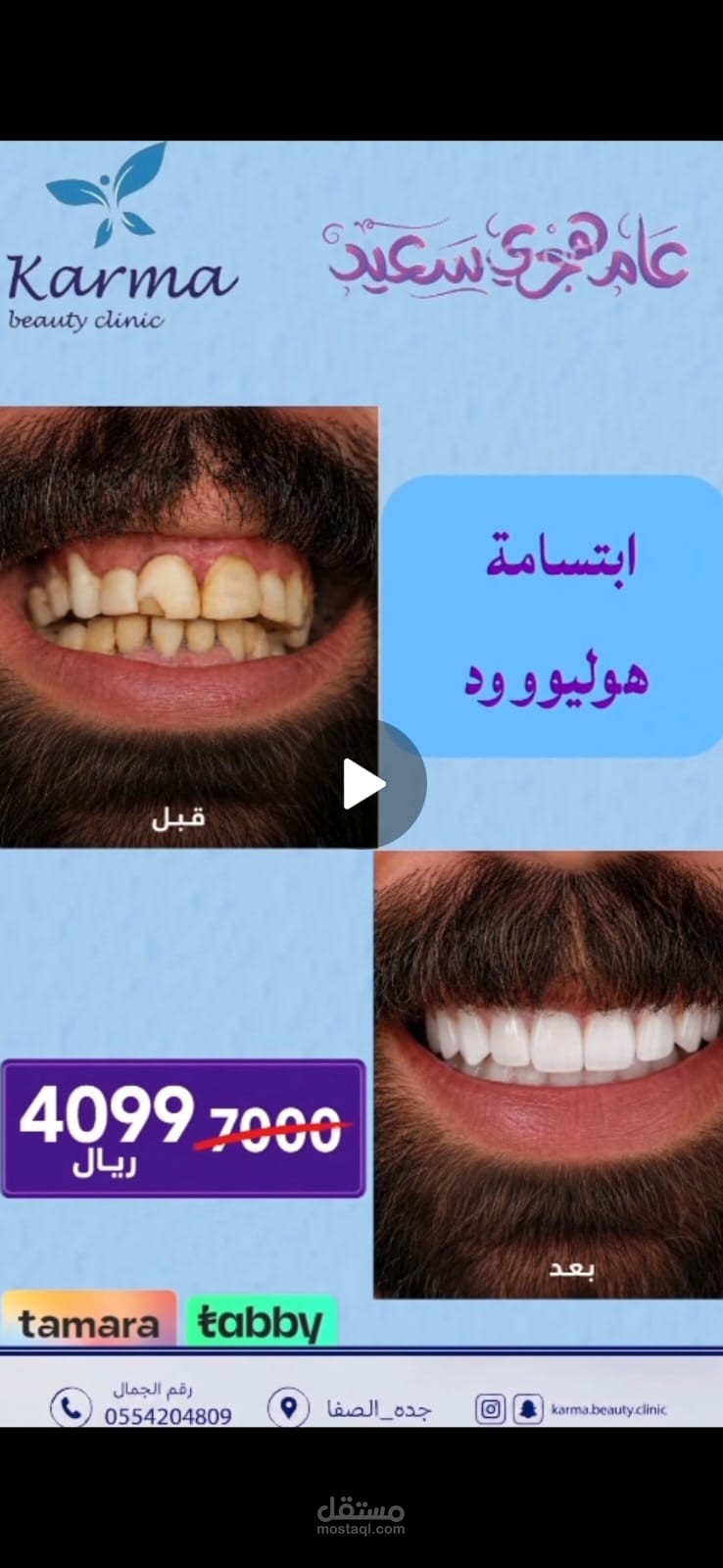 مونتاج وتصميم
