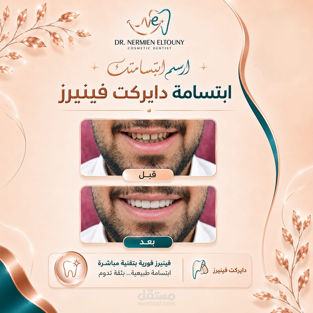 مونتاج للفيديو