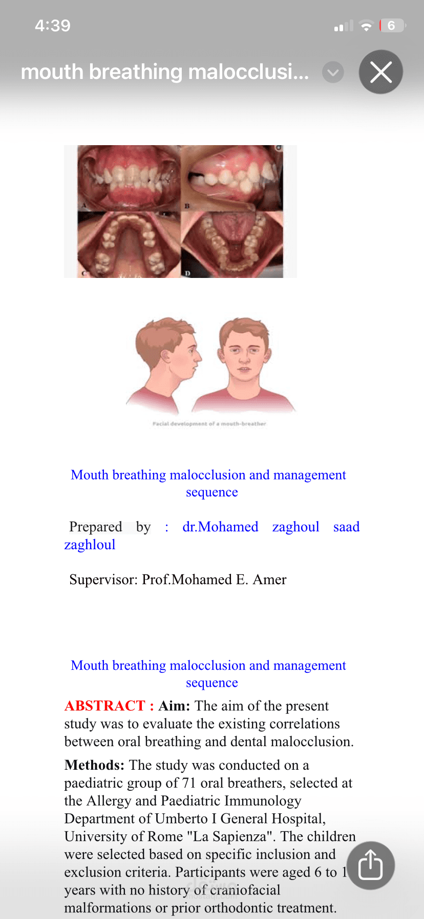 بحث طبي أكاديمي: تأثير تنفس الفم (Mouth Breathing) على إطباق الأسنان ونمو الفكين (Malocclusion