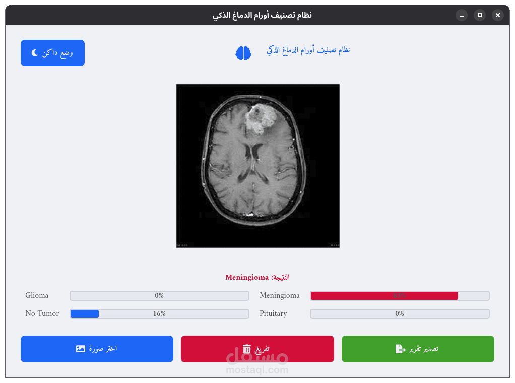 بناء نظام طبي ذكي لتصنيف وتشخيص أورام الدماغ باستخدام الذكاء الاصطناعي والتعلم العميق