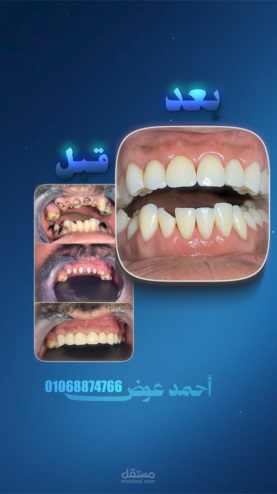 مونتاج فيديو ريلز اسنان