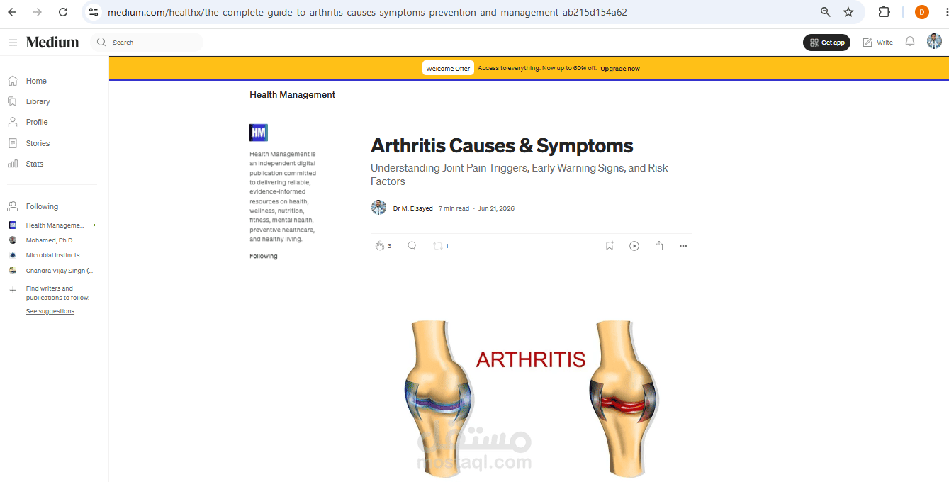 Arthritis Causes & Symptoms