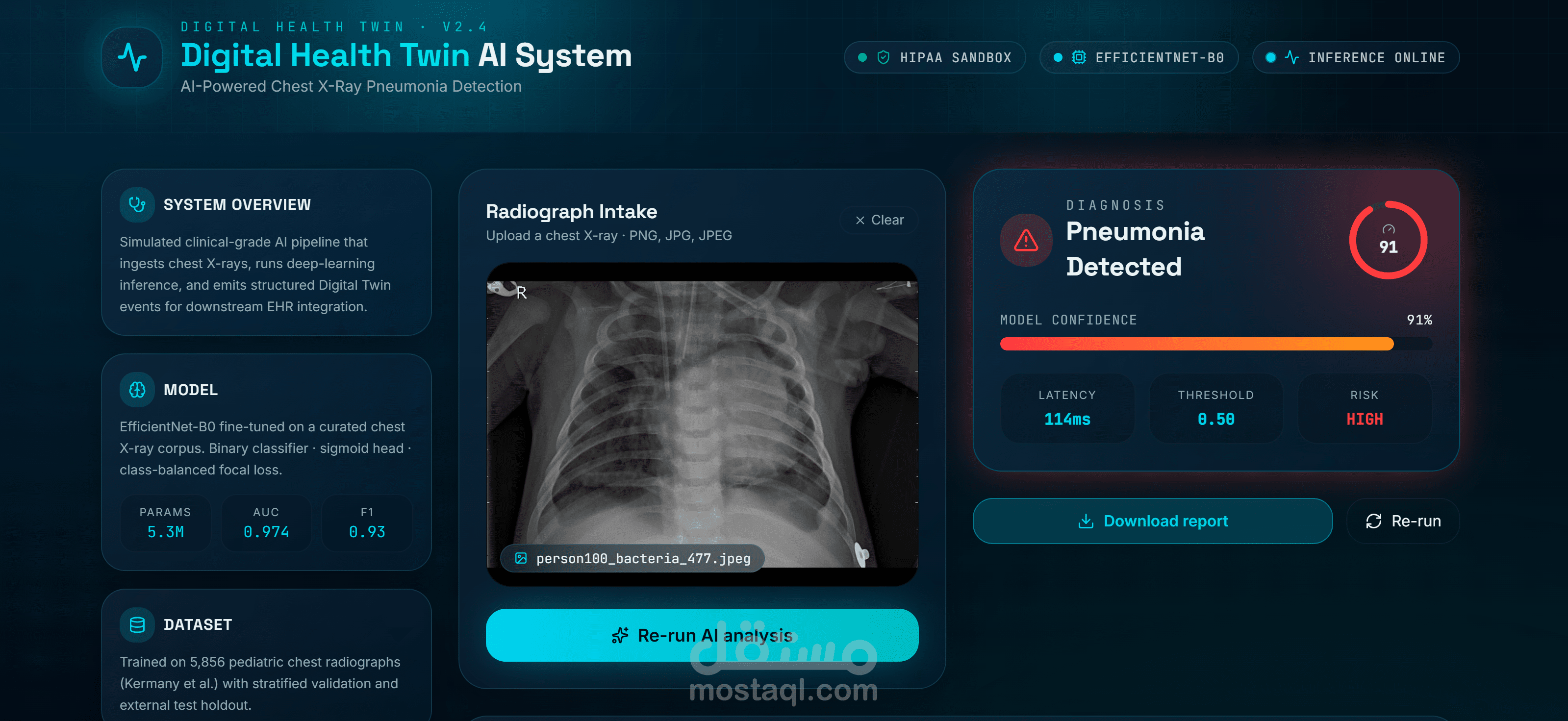 Digital Health Twin Diagnostics is a chest X-ray analysis