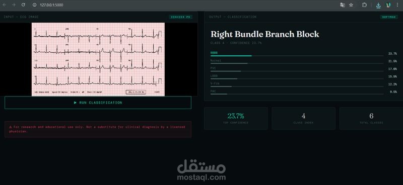 🩺 IA de classification ECG